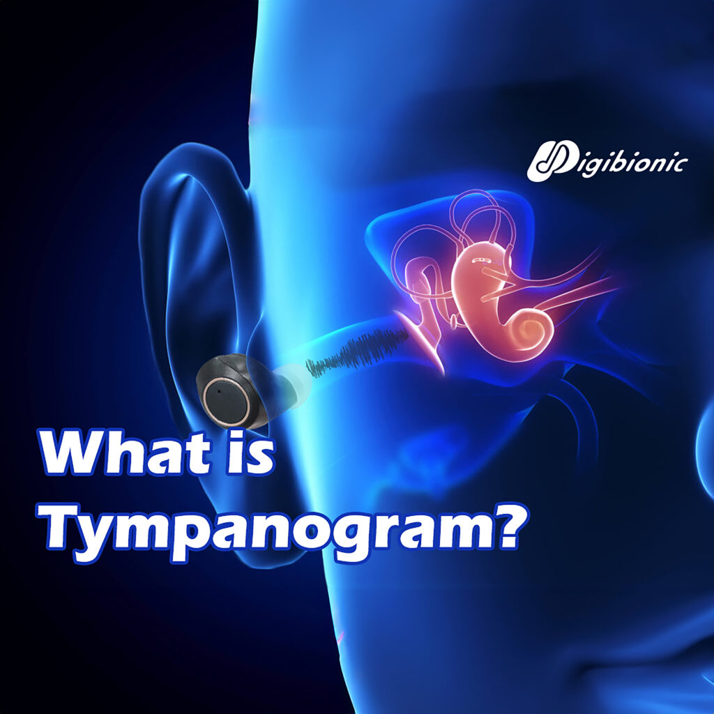 What is Tympanogram?