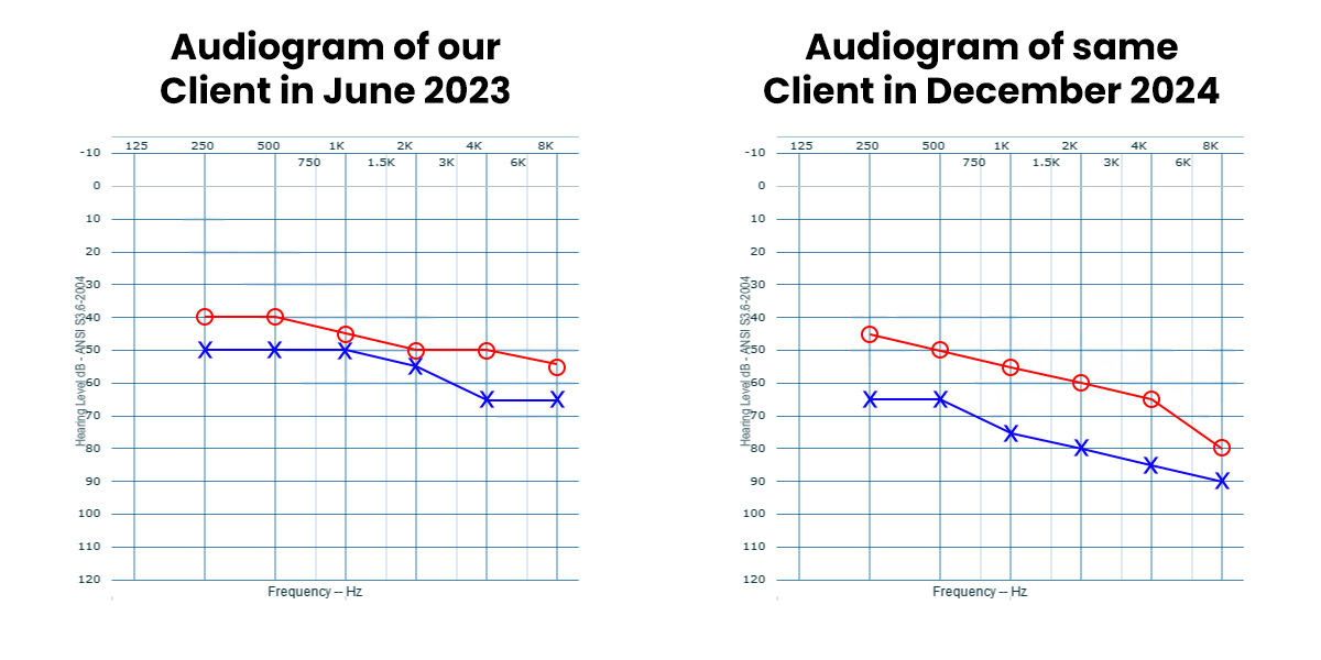 Hearing Loss difference within 