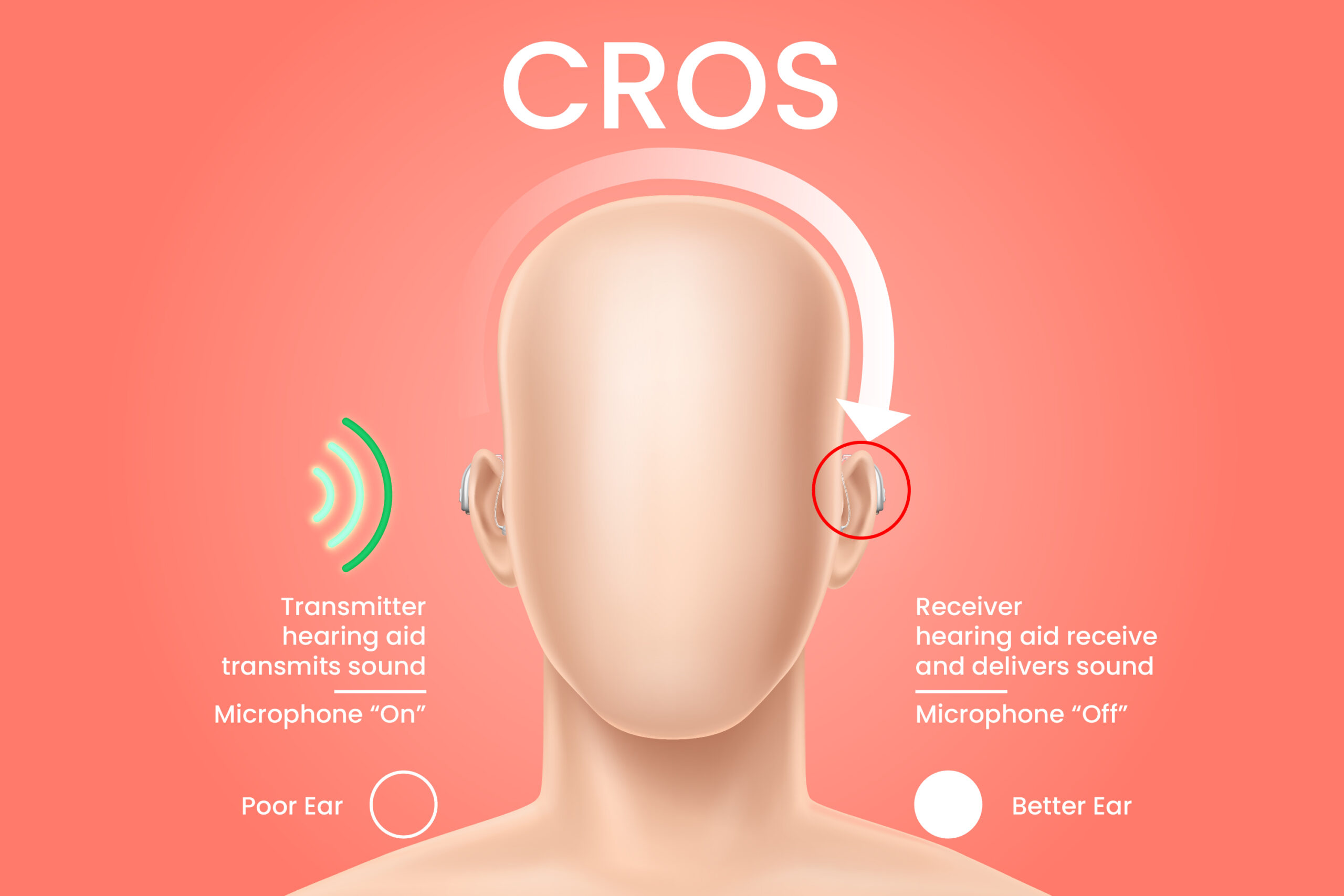 CROS Hearing Aids